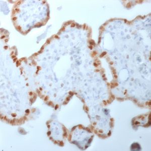 Formalin-fixed, paraffin-embedded human Placenta stained with DNMT1 Mouse Monoclonal Antibody (DNMT1/2061).