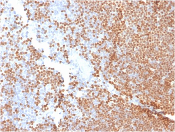 Formalin-fixed, paraffin-embedded human Thymus stained with TdTMouse Monoclonal Antibody (DNTT/1453).