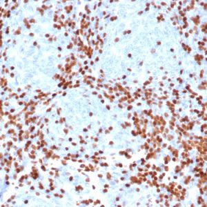 Formalin-fixed, paraffin-embedded human thymus stained with TdT Recombinant Mouse Monoclonal Antibody (rDNTT/6909).