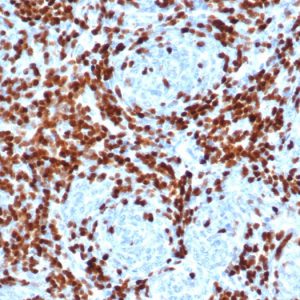 Formalin-fixed, paraffin-embedded human thymus stained with TdT Recombinant Rabbit Monoclonal Antibody (DNTT/4506R).