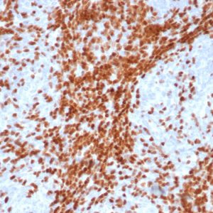 Formalin-fixed, paraffin-embedded human thymus stained with TdT Recombinant Rabbit Monoclonal Antibody (DNTT/4617R).