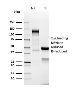 SDS-PAGE Analysis Purified TdT Recombinant Rabbit Monoclonal Antibody (DNTT/4617R). Confirmation of Purity and Integrity of Antibody.