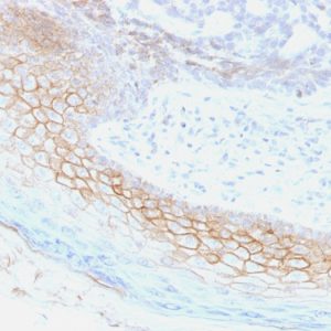 Formalin-fixed, paraffin-embedded human Skin stained with Desmocollin-2/3 Mouse Monoclonal Antibody (7G6).