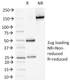 SDS-PAGE Analysis of Purified DSG1 Mouse Monoclonal Antibody (18D4). Confirmation of Integrity and Purity of Antibody