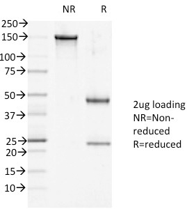 SDS-PAGE Analysis Purified DSG1 Mouse Monoclonal Antibody (27B2). Confirmation of Integrity and Purity of Antibody.