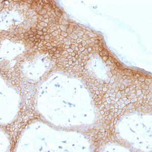 Formalin-fixed, paraffin-embedded human skin stained with Desmoglein-1 Monoclonal Antibody (DSG1/1733).
