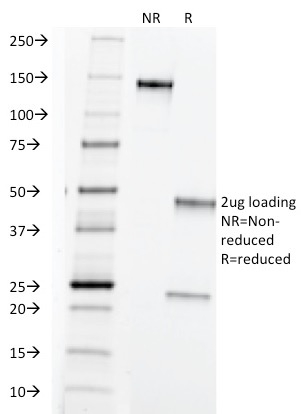 SDS-PAGE Analysis Purified TAG-72 Mouse Monoclonal Antibody (B72.3). Confirmation of Purity and Integrity of Antibody.