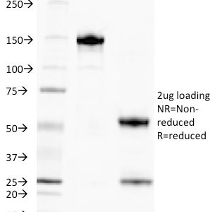 SDS-PAGE Analysis of Purified TAG-72 Mouse Monoclonal Antibody (CA72/145). Confirmation of Purity and Integrity of Antibody.