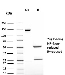 SDS-PAGE Analysis Purified TAG-72 Recombinant Mouse Monoclonal Antibody (rB72.3). Confirmation of Purity and Integrity of Antibody.