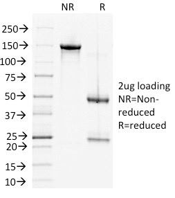 SDS-PAGE Analysis Purified DSG2 Mouse Monoclonal Antibody (6D8). Confirmation of Integrity and Purity of Antibody.
