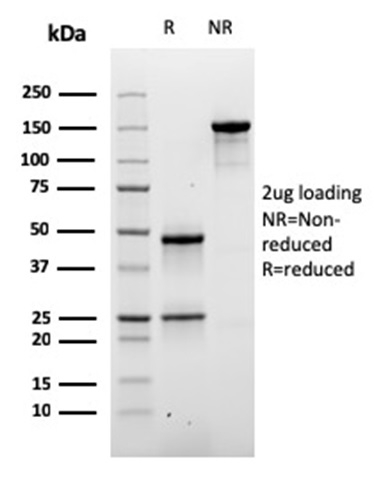 SDS-PAGE Analysis of Purified Desmoglein-3 Mouse Monoclonal Antibody (DSG3/2840). Confirmation of Purity and Integrity of Antibody