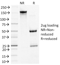 SDS-PAGE Analysis Purified Desmoglein-3 Monoclonal Antibody (5G11). Confirmation of Integrity and Purity of Antibody