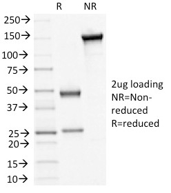 SDS-PAGE Analysis Purified Desmoglein-3 Monoclonal Antibody (5H10). Confirmation of Integrity and Purity of Antibody.