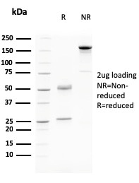 SDS-PAGE Analysis of Purified Desmoglein-3 Mouse Monoclonal Antibody (DSG3/2796). Confirmation of Purity and Integrity of Antibody.