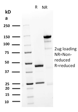 SDS-PAGE Analysis Purified Desmoglein-3 Mouse Monoclonal Antibody (DSG3/2839). Confirmation of Purity and Integrity of Antibody.