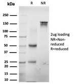 SDS-PAGE Analysis Purified E2F6 Mouse Monoclonal Antibody (PCRP-E2F6-1F8). Confirmation of Purity and Integrity of Antibody.
