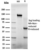 SDS-PAGE Analysis Purified E4F1 Mouse Monoclonal Antibody (PCRP-E4F1-2D1). Confirmation of Purity and Integrity of Antibody.