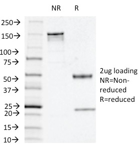 SDS-PAGE Analysis Purified Thymidine Phosphorylase / PD-ECGF Mouse Monoclonal Antibody (P-GF.44C). Confirmation of Integrity and Purity of Antibody