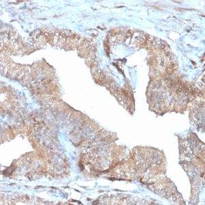 Formalin-fixed, paraffin-embedded human Placenta stained with PD-ECGF Recombinant Mouse Monoclonal Antibody (rTYMP/3444).