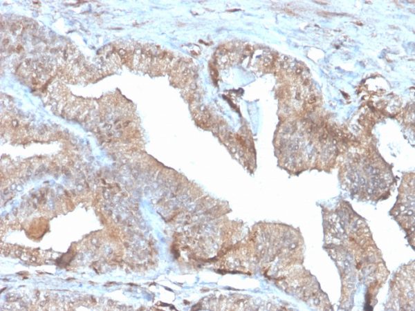 Formalin-fixed, paraffin-embedded human Placenta stained with PD-ECGF Recombinant Mouse Monoclonal Antibody (rTYMP/3444).