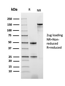 SDS-PAGE Analysis of Purified PD-ECGF Recombinant Mouse Monoclonal Antibody (rTYMP/3444). Confirmation of Integrity and Purity of Antibody