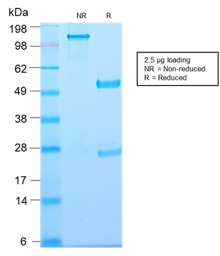 SDS-PAGE Analysis of Purified Thymidine Phosphorylase Rabbit Recombinant Monoclonal (TYMP/2890R). Confirmation of Purity and Integrity of Antibody.