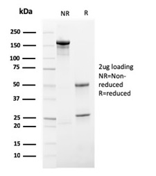 SDS-PAGE Analysis of Purified Secretory Component Mouse Monoclonal Antibody (SPM217). Confirmation of Purity and Integrity of Antibody.