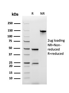 SDS-PAGE Analysis Purified ECM1 Recombinant Mouse Monoclonal Antibody (rSPM217). Confirmation of Purity and Integrity of Antibody.