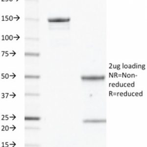 SDS-PAGE Analysis Purified EGFR Mouse Monoclonal Antibody (GFR/450). Confirmation of Integrity and Purity of Antibody.