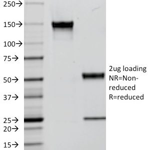 SDS-PAGE Analysis Purified EGFR Mouse Monoclonal Antibody (F4). Confirmation of Integrity and Purity of Antibody.