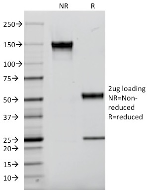 SDS-PAGE Analysis Purified EGFR Mouse Monoclonal Antibody (F4). Confirmation of Integrity and Purity of Antibody.