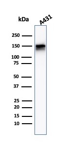Western Blot Analysis of A431 cell lysate using EGFR Mouse Monoclonal Antibody (F4).