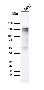 Western Blot Analysis of A431 cell lysate using EGFR Mouse Monoclonal Antibody (SPM341).