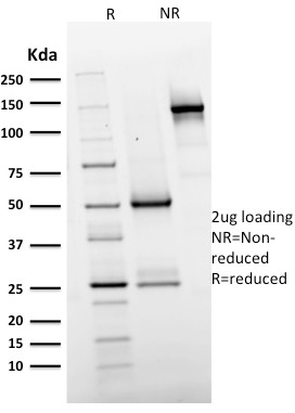 SDS-PAGE Analysis Purified EGFR Mouse Monoclonal Antibody (GFR/2596). Confirmation of Integrity and Purity of Antibody.