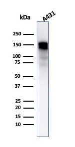Western Blot Analysis of A431 cell lysate using EGFR Mouse Monoclonal Antibody (GFR/2596).