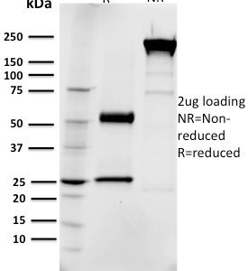 SDS-PAGE Analysis Purified EGFR Mouse Monoclonal Antibody (R1). Confirmation of Integrity and Purity of Antibody.
