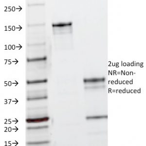 SDS-PAGE Analysis Purified EGFR Mouse Monoclonal Antibody (B1D8). Confirmation of Integrity and Purity of Antibody.