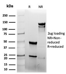 SDS-PAGE Analysis of Purified EGFR Recombinant Mouse Monoclonal Antibody (rEGFR/6389). Confirmation of Purity and Integrity of Antibody.