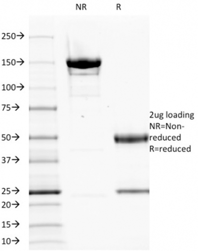 SDS-PAGE Analysis of Purified EGFR Mouse Monoclonal Antibody (GFR1195). Confirmation of Integrity and Purity of Antibody