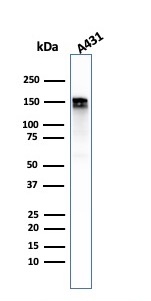 Western Blot Analysis of A431 cell lysate using EGFR-Monospecific Recombinant Rabbit Monoclonal Antibody (GFR/2968R).