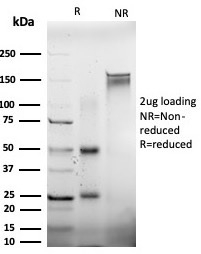SDS-PAGE Analysis Purified EIF2S1 Mouse Monoclonal Antibody (PCRP-EIF2S1-1E2) Confirmation of Purity and Integrity of Antibody.