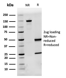 SDS-PAGE Analysis of Purified Fetuin / AHSG Mouse Monoclonal Antibody (AHSG/3748). Confirmation of Purity and Integrity of Antibody.