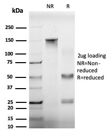 SDS-PAGE Analysis Purified EIF4A2 Mouse Monoclonal Antibody (PCRP-EIF4A2-2B5). Confirmation of Purity and Integrity of Antibody.