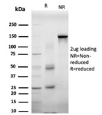 SDS-PAGE Analysis Purified EIF4E Mouse Monoclonal Antibody (PCRP-EIF4E-1D3). Confirmation of Purity and Integrity of Antibody. EIF4E Antibody - Image 6