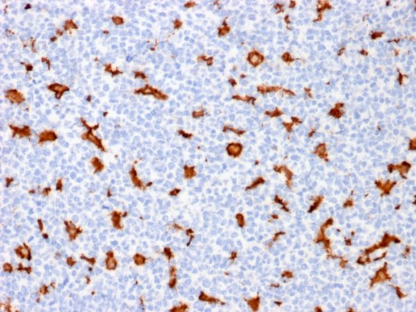 Formalin-fixed, paraffin-embedded human Tonsil stained with AIF1 / Iba1 Mouse Monoclonal Antibody (AIF1/1909).