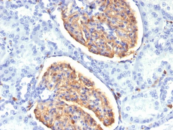 Formalin-fixed, paraffin-embedded human Kidney stained with AIF1 / Iba1 Mouse Monoclonal Antibody (AIF1/1909).