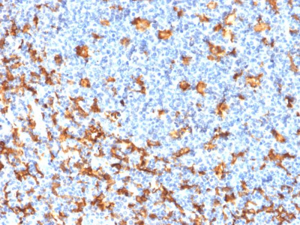 Formalin-fixed, paraffin-embedded Human Tonsil stained with AIF1 / Iba1 Mouse Recombinant Monoclonal Antibody (rAIF1/1909).
