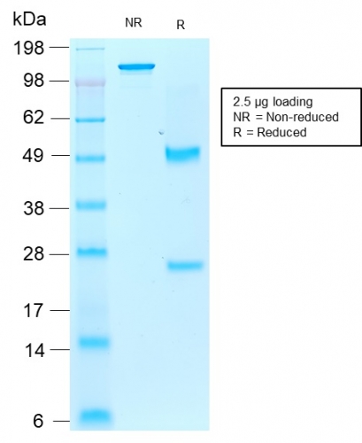 SDS-PAGE Analysis of Purified AIF1 / Iba1 Mouse Recombinant Monoclonal Antibody (rAIF1/1909). Confirmation of Integrity and Purity of Antibody.