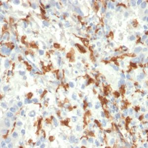 Formalin-fixed, paraffin-embedded human Kidney stained with AIF1 / Iba1 Mouse Monoclonal Antibody (AIF1/2493).
