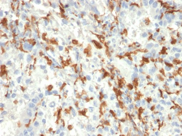 Formalin-fixed, paraffin-embedded human Kidney stained with AIF1 / Iba1 Mouse Monoclonal Antibody (AIF1/2493).
